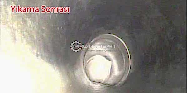 Kanal yıkama sonrası